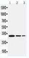 TNF Receptor Associated Factor 1 antibody, PA5-80179, Invitrogen Antibodies, Western Blot image 