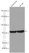 Transglutaminase 7 antibody, 27748-1-AP, Proteintech Group, Western Blot image 