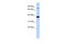 Zinc Finger Protein 526 antibody, 25-045, ProSci, Western Blot image 