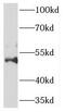 Homeobox C10 antibody, FNab03980, FineTest, Western Blot image 