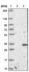 Steroidogenic Acute Regulatory Protein antibody, NBP1-86993, Novus Biologicals, Western Blot image 