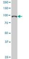 General Transcription Factor IIIC Subunit 3 antibody, H00009330-M02, Novus Biologicals, Western Blot image 