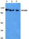 Apolipoprotein B Receptor antibody, PA5-75801, Invitrogen Antibodies, Western Blot image 