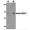 AlkB Homolog 2, Alpha-Ketoglutarate Dependent Dioxygenase antibody, MBS151067, MyBioSource, Western Blot image 