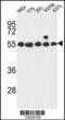 G Protein-Coupled Receptor 180 antibody, 64-116, ProSci, Western Blot image 