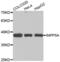 Type I inositol-1,4,5-trisphosphate 5-phosphatase antibody, abx002349, Abbexa, Western Blot image 