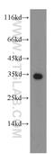 Hydroxyacyl-CoA Dehydrogenase antibody, 19828-1-AP, Proteintech Group, Western Blot image 