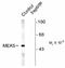 Mitogen-Activated Protein Kinase Kinase 5 antibody, NB100-61105, Novus Biologicals, Western Blot image 