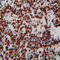 TAR DNA Binding Protein antibody, GTX30809, GeneTex, Immunohistochemistry paraffin image 