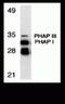 Acidic Nuclear Phosphoprotein 32 Family Member A antibody, NBP2-81784, Novus Biologicals, Western Blot image 