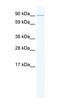 Gamma-Aminobutyric Acid Type A Receptor Gamma2 Subunit antibody, orb329882, Biorbyt, Western Blot image 