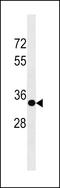 Sprouty RTK Signaling Antagonist 3 antibody, LS-C203784, Lifespan Biosciences, Western Blot image 