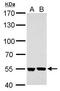 Serine Hydroxymethyltransferase 2 antibody, GTX125939, GeneTex, Western Blot image 