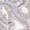 Transketolase Like 1 antibody, NBP1-86939, Novus Biologicals, Immunohistochemistry frozen image 