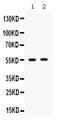 SET and MYND domain-containing protein 3 antibody, PB9893, Boster Biological Technology, Western Blot image 