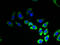 Transmembrane Protein 53 antibody, A63648-100, Epigentek, Immunofluorescence image 