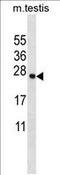 Transmembrane Protein 18 antibody, AP54291PU-N, Origene, Western Blot image 