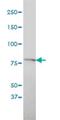 Solute Carrier Family 20 Member 1 antibody, H00006574-M01, Novus Biologicals, Western Blot image 