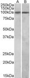 HIC ZBTB Transcriptional Repressor 1 antibody, STJ72861, St John