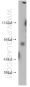 Cytochrome P450 Family 26 Subfamily B Member 1 antibody, 21555-1-AP, Proteintech Group, Western Blot image 