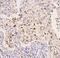 SWI/SNF Related, Matrix Associated, Actin Dependent Regulator Of Chromatin, Subfamily A, Member 4 antibody, M00223-1, Boster Biological Technology, Immunohistochemistry frozen image 