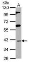 ISL LIM Homeobox 1 antibody, PA5-27789, Invitrogen Antibodies, Western Blot image 