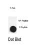 Cyclin Dependent Kinase 7 antibody, abx031850, Abbexa, Immunohistochemistry paraffin image 