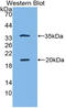 SPINK5 antibody, LS-B15858, Lifespan Biosciences, Western Blot image 