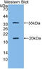 Serine Peptidase Inhibitor, Kazal Type 5 antibody, LS-B15858, Lifespan Biosciences, Western Blot image 