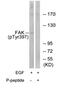 Protein Tyrosine Kinase 2 antibody, MBS003561, MyBioSource, Western Blot image 