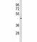 Suppressor Of Variegation 3-9 Homolog 2 antibody, F47078-0.4ML, NSJ Bioreagents, Western Blot image 