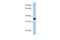 Homeobox D1 antibody, A12487, Boster Biological Technology, Western Blot image 