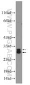 Steroid receptor RNA activator 1 antibody, 24655-1-AP, Proteintech Group, Western Blot image 