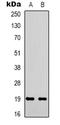 Stathmin 1 antibody, orb338903, Biorbyt, Western Blot image 