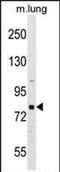 Rhophilin Rho GTPase Binding Protein 1 antibody, PA5-72047, Invitrogen Antibodies, Western Blot image 