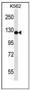 RAS Protein Activator Like 2 antibody, AP53585PU-N, Origene, Western Blot image 