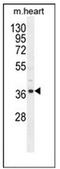 NADH:Ubiquinone Oxidoreductase Complex Assembly Factor 3 antibody, AP52836PU-N, Origene, Western Blot image 