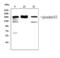 Angiotensin I Converting Enzyme antibody, LS-C343986, Lifespan Biosciences, Western Blot image 