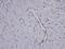 Coronin 1C antibody, NBP1-31283, Novus Biologicals, Immunohistochemistry paraffin image 