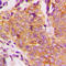Glycogen Synthase Kinase 3 Beta antibody, LS-C352304, Lifespan Biosciences, Immunohistochemistry frozen image 