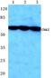 Checkpoint Kinase 2 antibody, AP06052PU-N, Origene, Western Blot image 