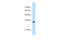 Apolipoprotein B MRNA Editing Enzyme Catalytic Subunit 3D antibody, 29-509, ProSci, Enzyme Linked Immunosorbent Assay image 