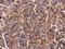 Baculoviral IAP Repeat Containing 5 antibody, GTX100441, GeneTex, Immunohistochemistry paraffin image 