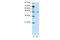 Ribosomal Oxygenase 2 antibody, 29-116, ProSci, Western Blot image 