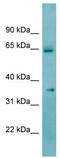 Ketohexokinase antibody, TA346115, Origene, Western Blot image 