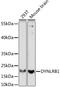 Dynein Light Chain Roadblock-Type 1 antibody, A15197, ABclonal Technology, Western Blot image 