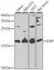 Death-associated protein 1 antibody, GTX32550, GeneTex, Western Blot image 