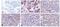 Plasminogen Activator, Urokinase Receptor antibody, MON U-12-02, Invitrogen Antibodies, Immunohistochemistry frozen image 
