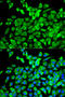 Eukaryotic Translation Initiation Factor 4A1 antibody, STJ27247, St John