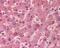 Alpha-1-antitrypsin antibody, 49-484, ProSci, Immunohistochemistry paraffin image 
